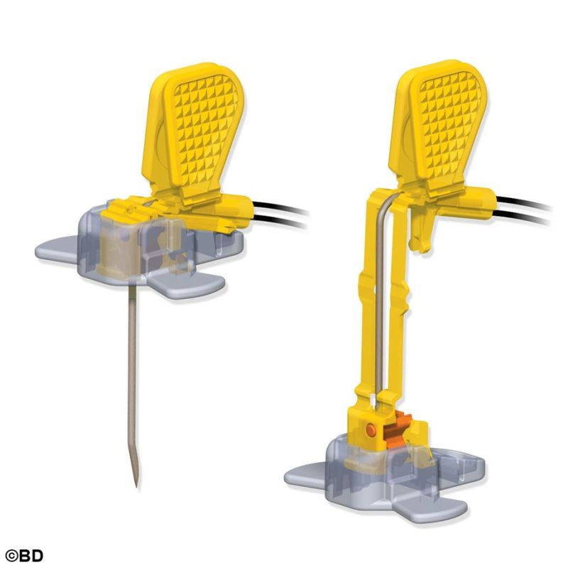 MiniLoc Sicherheitsinfusionsset